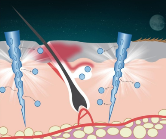 그림입니다. 원본 그림의 이름: MTS(1).png 원본 그림의 크기: 가로 386pixel, 세로 414pixel