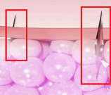 그림입니다. 원본 그림의 이름: MTS(2).png 원본 그림의 크기: 가로 373pixel, 세로 363pixel