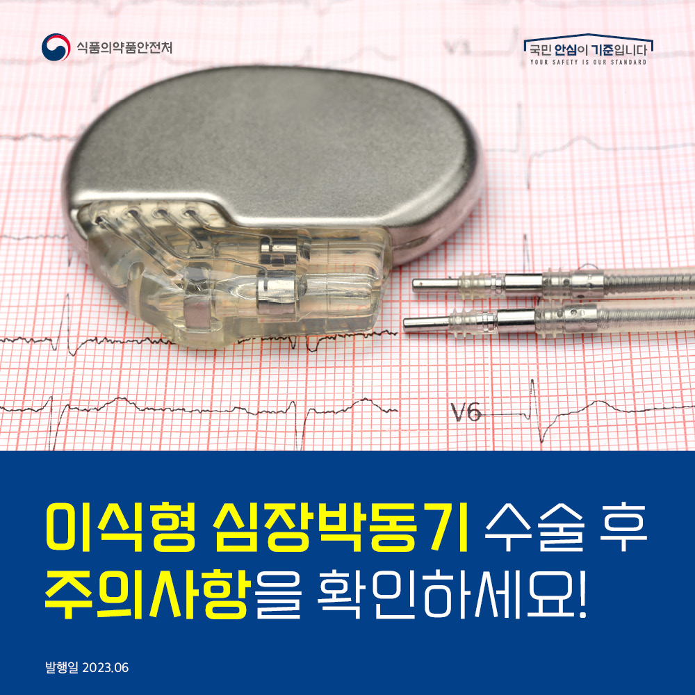 이식형 심장박동기 수술 후 주의사항을 확인하세요