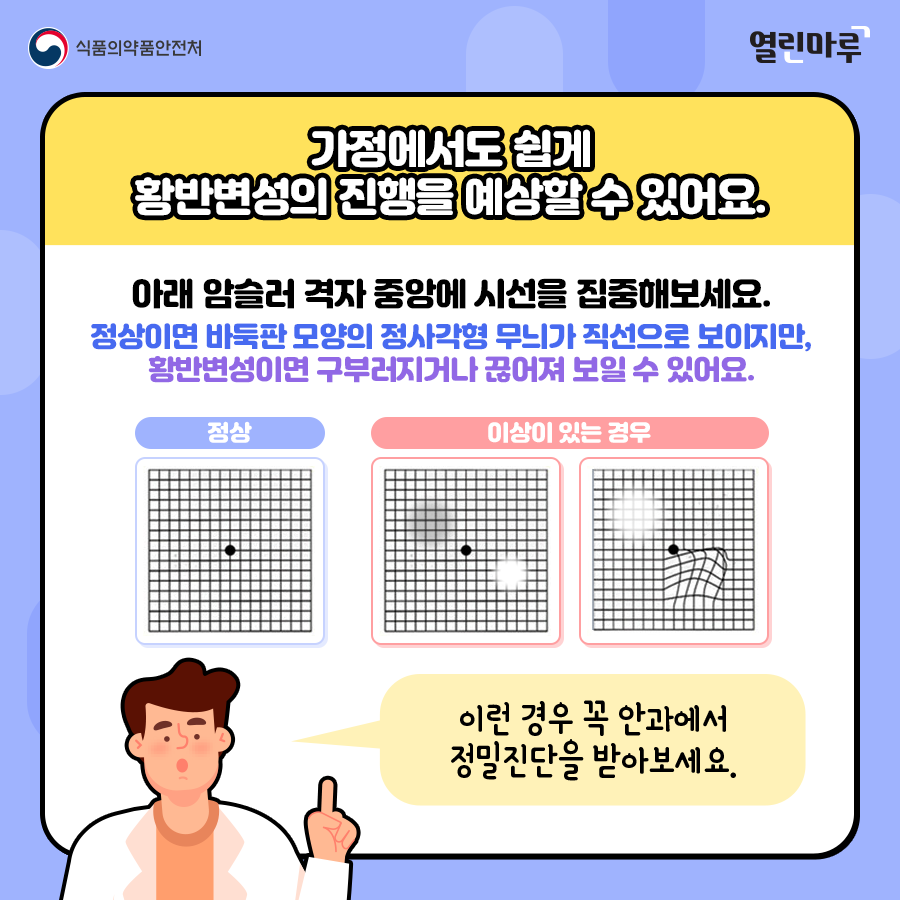 가정에서도 쉽게 황반변성의 진행을 예상할 수 있어요. 아래 암슬러 격자 중앙에 시선을 집중해보세요. 정상이면 바둑판 모양의 정사각형 무늬가 직선으로 보이지만, 황반변성이면 구부러지거나 끊어져 보일 수 있어요. 이런 경우 꼭 안과에서 정밀진단을 받아보세요.