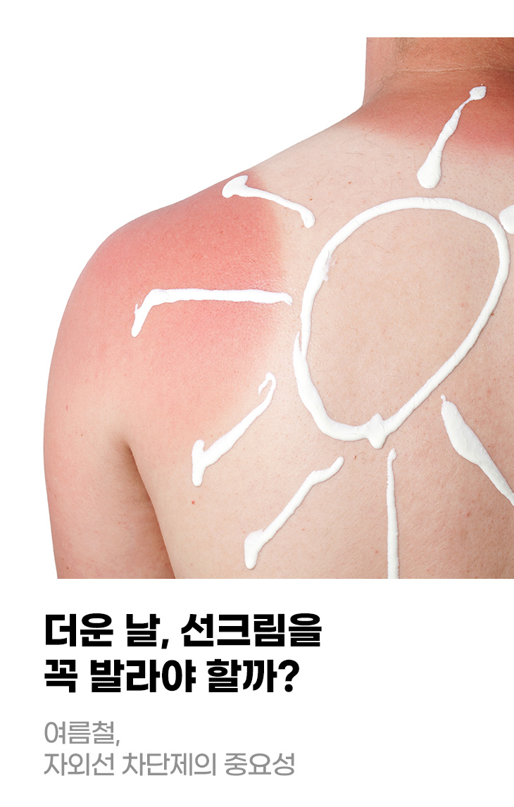 더운 날, 선크림을 꼭 발라야 할까? 여름철, 자외선 차단제의 중요성