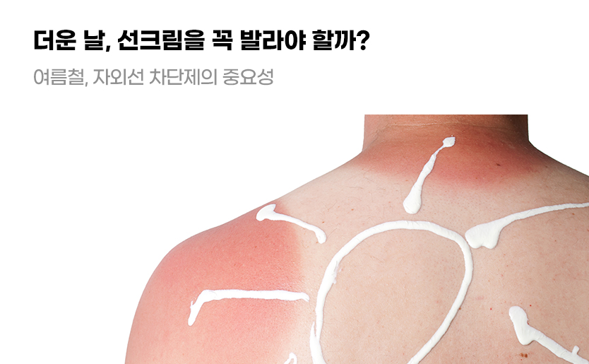 더운 날, 선크림을 꼭 발라야 할까? 여름철, 자외선 차단제의 중요성