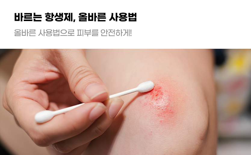 바르는 항생제, 올바른 사용법 올바른 사용법으로 피부를 안전하게!